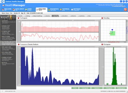 Autonomic Nervous System Testing, ANS Testing, Autonomic Testing